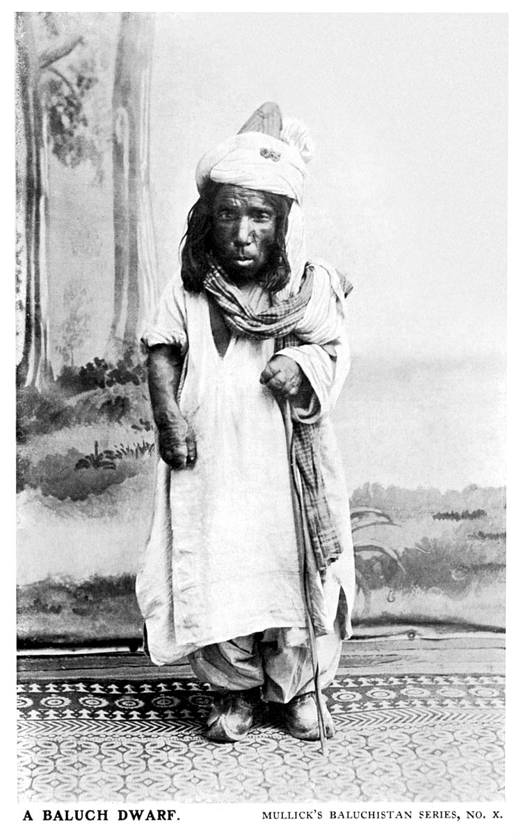 A Baluch Dwarf