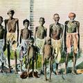 Group of Famine-Stricken Victims.